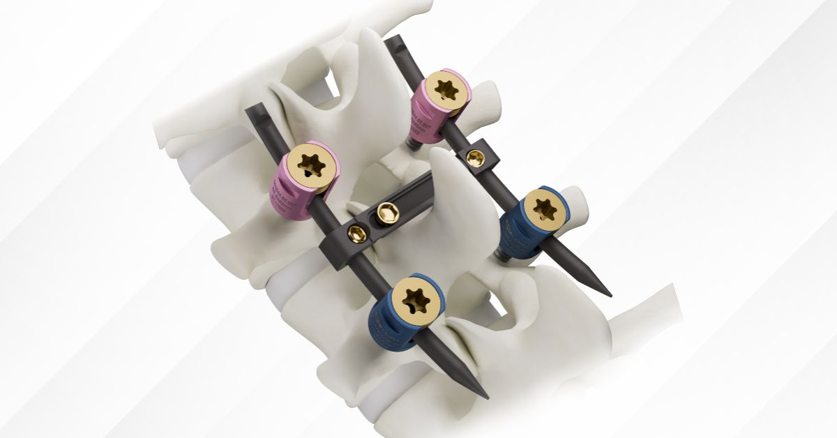 Spine Implant System