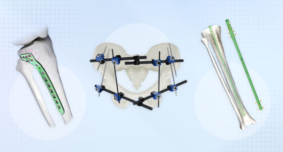 Best Practices for Choosing the Right Implant for Trauma Cases