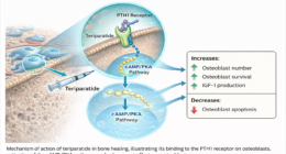 Role of Teriparatide in Fracture Healing