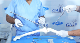 Suprapatellar vs Infrapatellar Intramedullary Nailing in Tibial Shaft Fractures