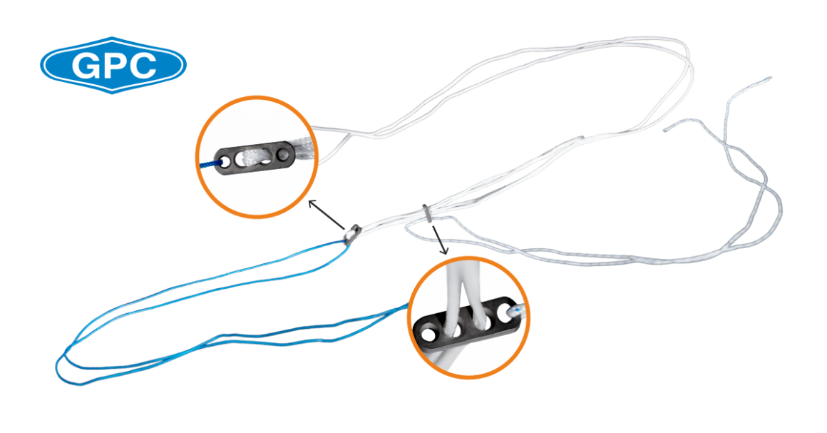 Suspensory Fixation in Anterior Cruciate Ligament Reconstruction