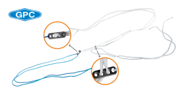 Suspensory Fixation in Anterior Cruciate Ligament Reconstruction