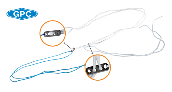 Suspensory Fixation in Anterior Cruciate Ligament Reconstruction