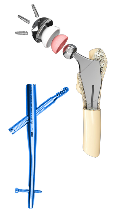 GPC Orthopedic Division