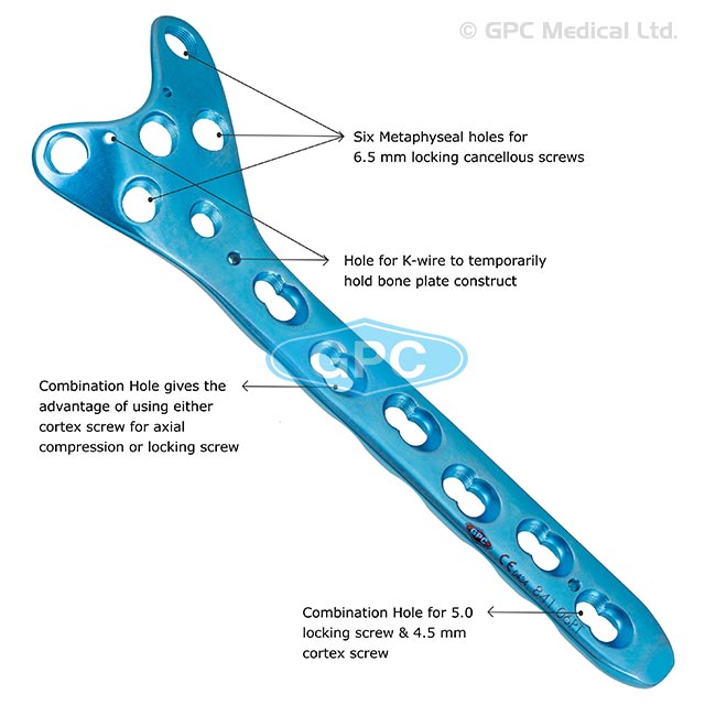 4.5mm Locking Condylar Buttress Plates