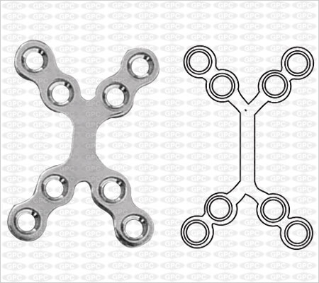 Double Y-Plate 2.0