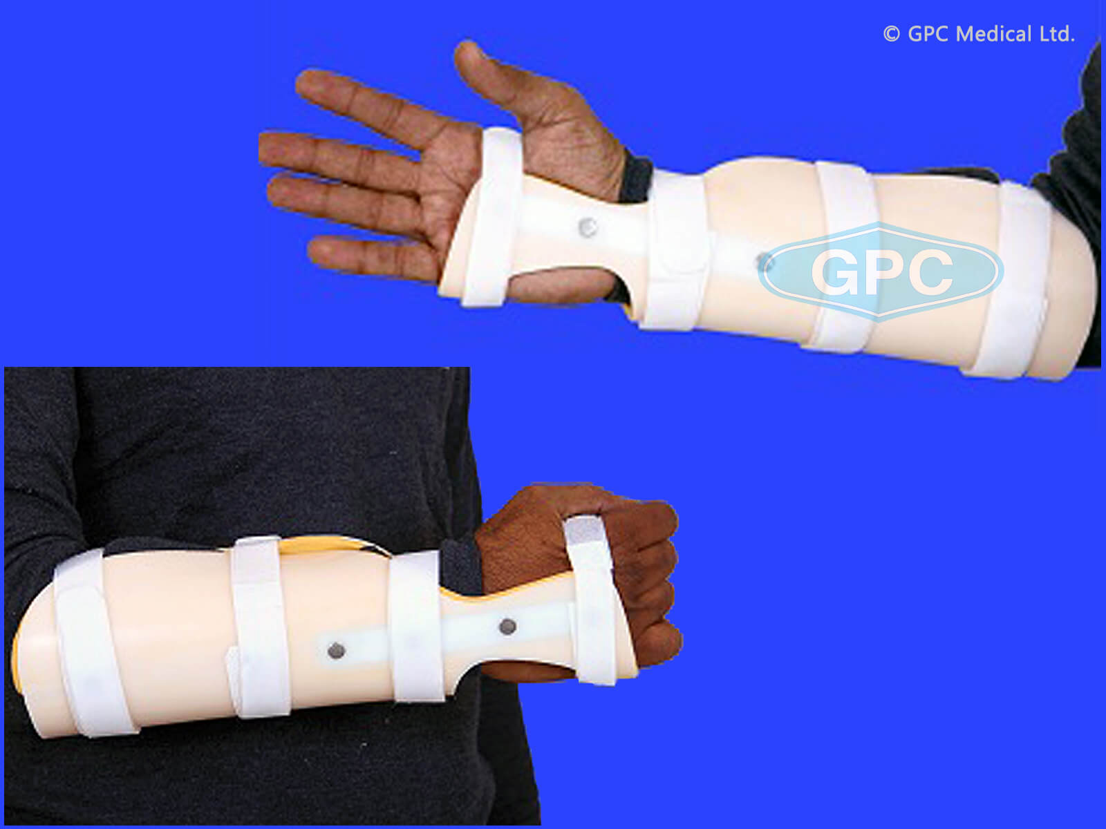 Forearm Splint 