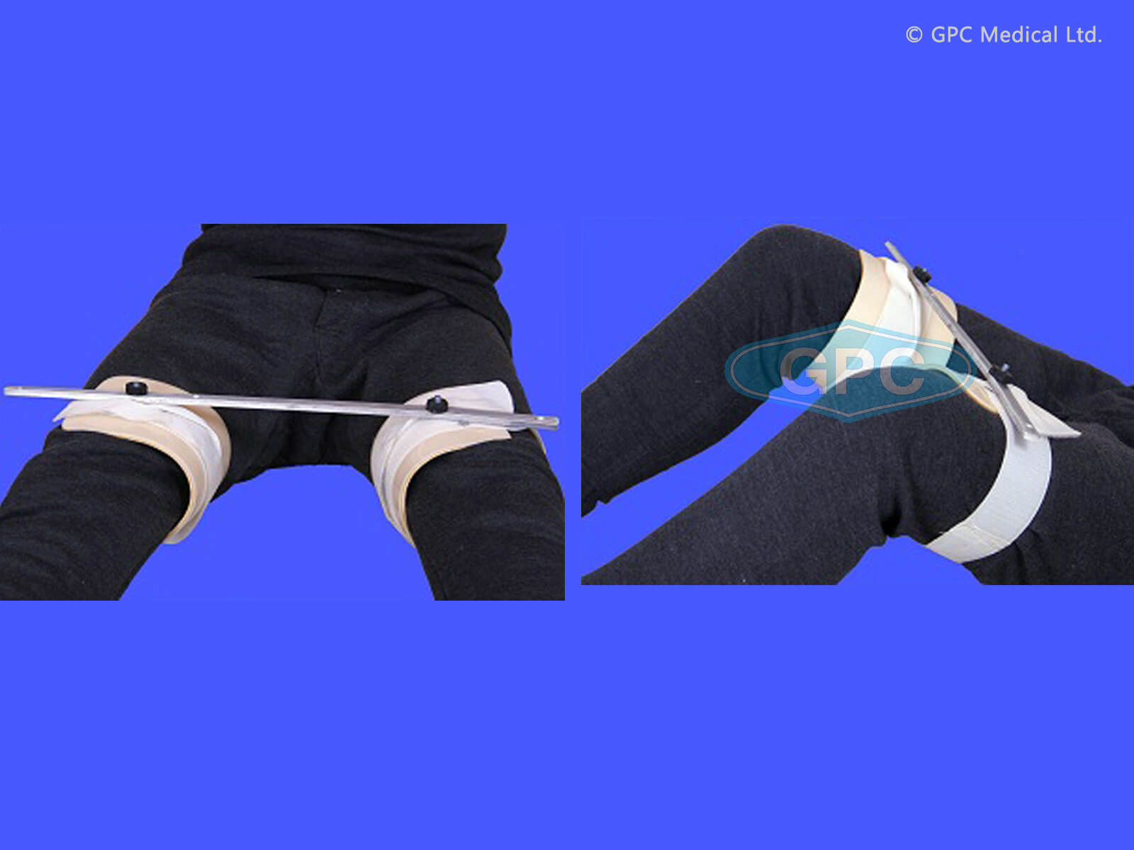 Hip Abduction Splint