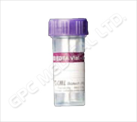 K3 EDTA Vials (Violet Caps)