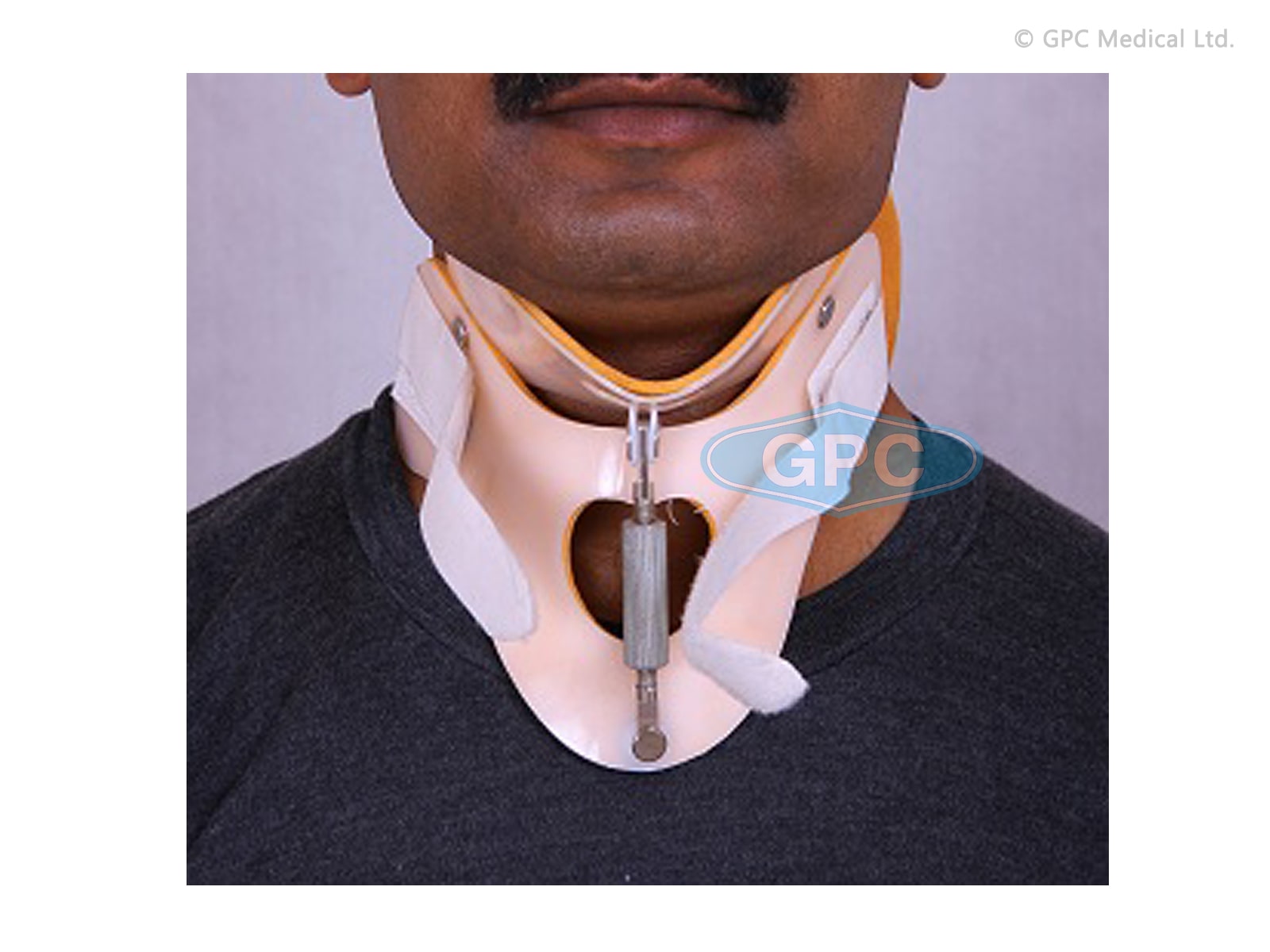 Turn Buckle Cervical