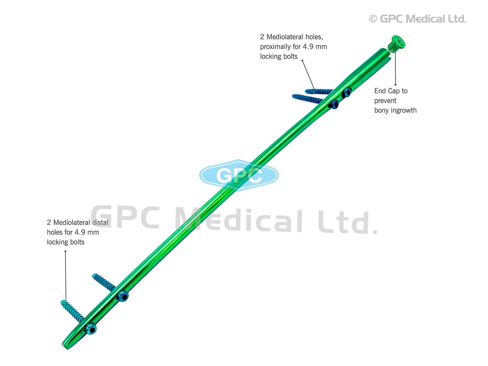 Femoral Nails (Stainless Steel)