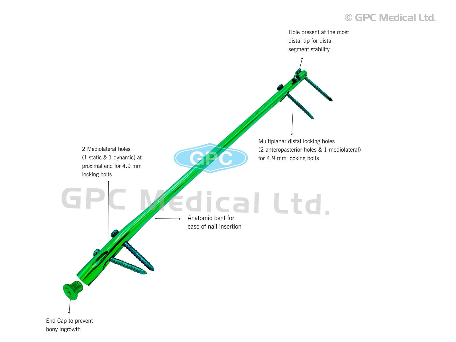 Tibia Interlocking Nail Distal Tip (Stainless Steel)