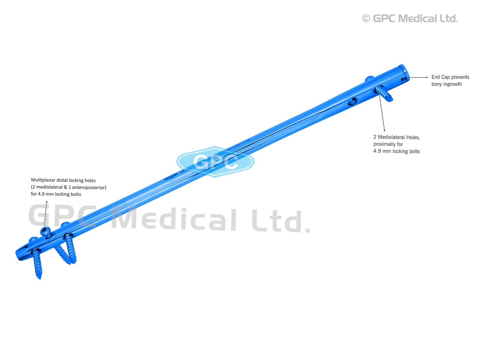 Supra Condylar Nail