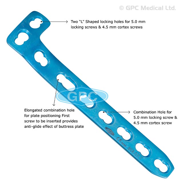 L-Buttress Locking Plate