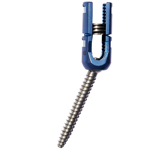 Single Lock Polyaxial Reduction Screw